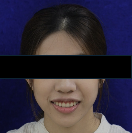 術後